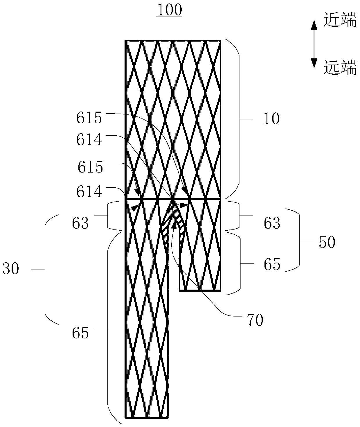 Bifurcation bracket