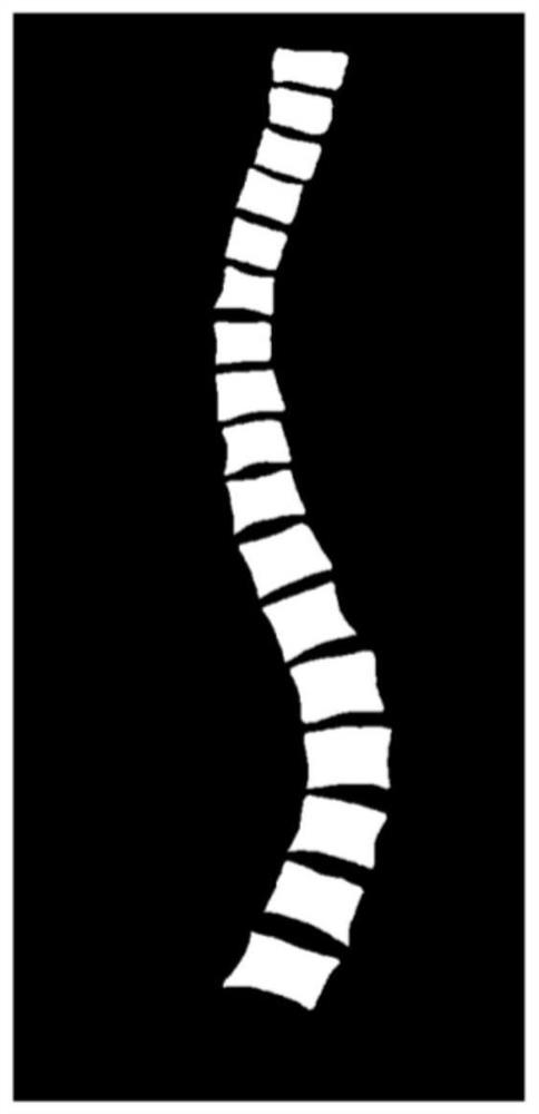 Method for detecting scoliosis, equipment and medium