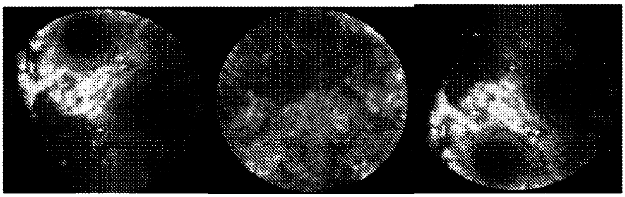 Visual representation learning for brain tumor classification