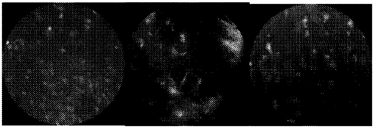 Visual representation learning for brain tumor classification