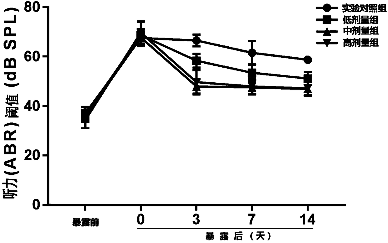 Application of melbine in preparing NIHL (Noise Induced Hearing Loss) prevention product