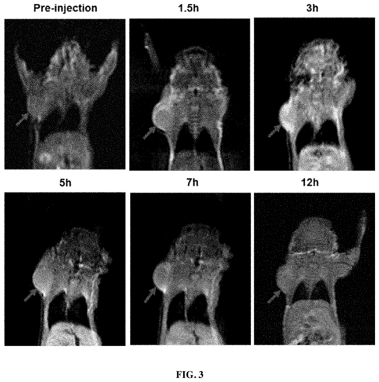 Tumor-targeting, clearable human protein-based MRI nanoprobes, and compositions and methods thereof