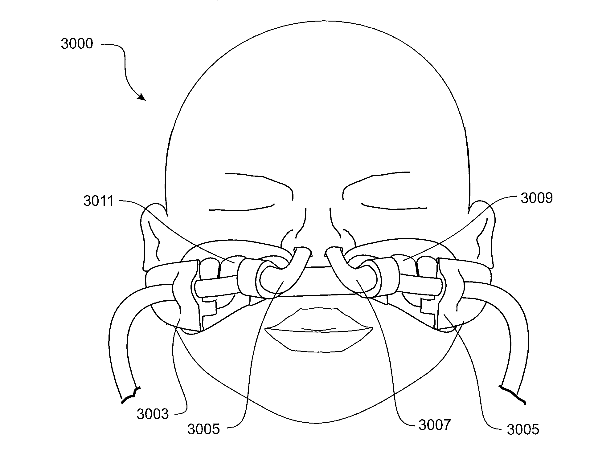 Patient interface