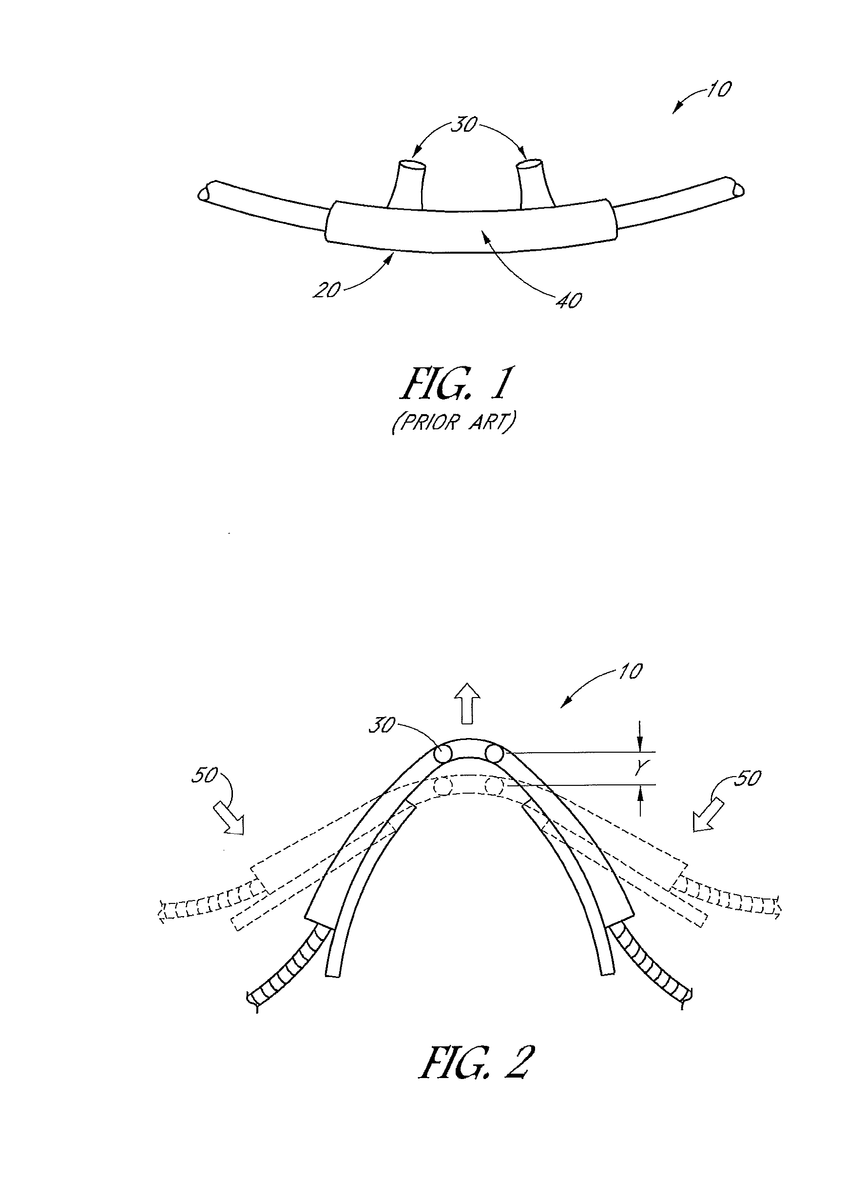 Patient interface