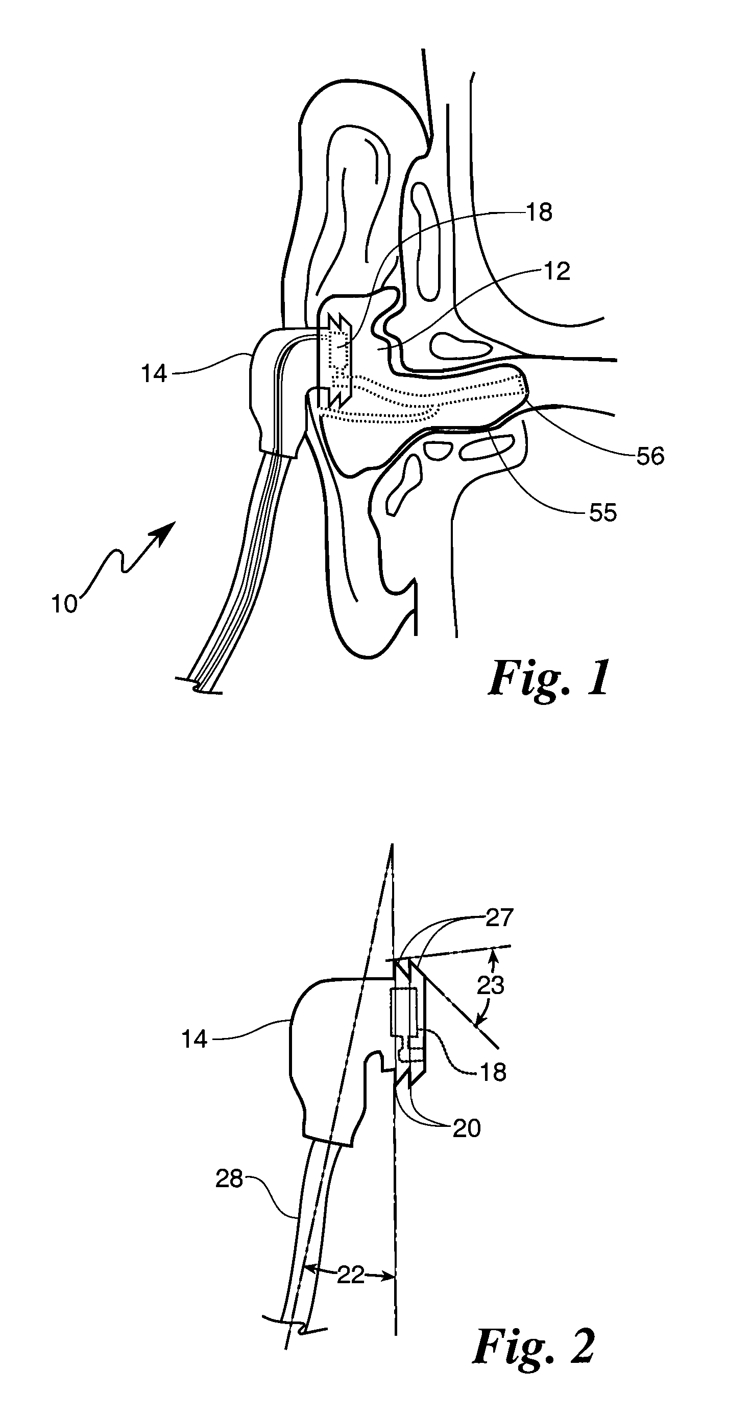 Deep insertion vented earpiece system