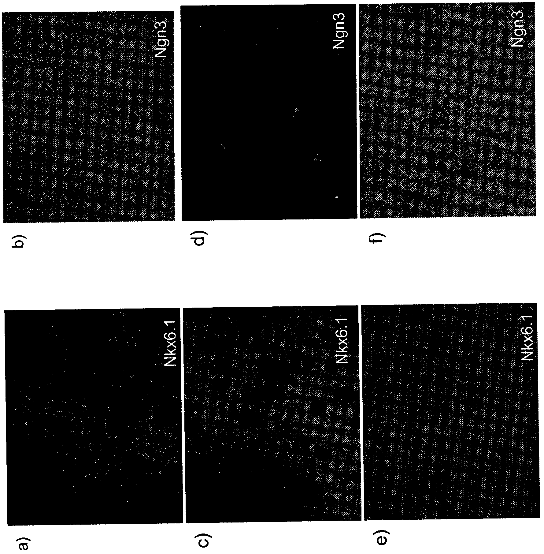 Differentiation of human embryonic stem cells