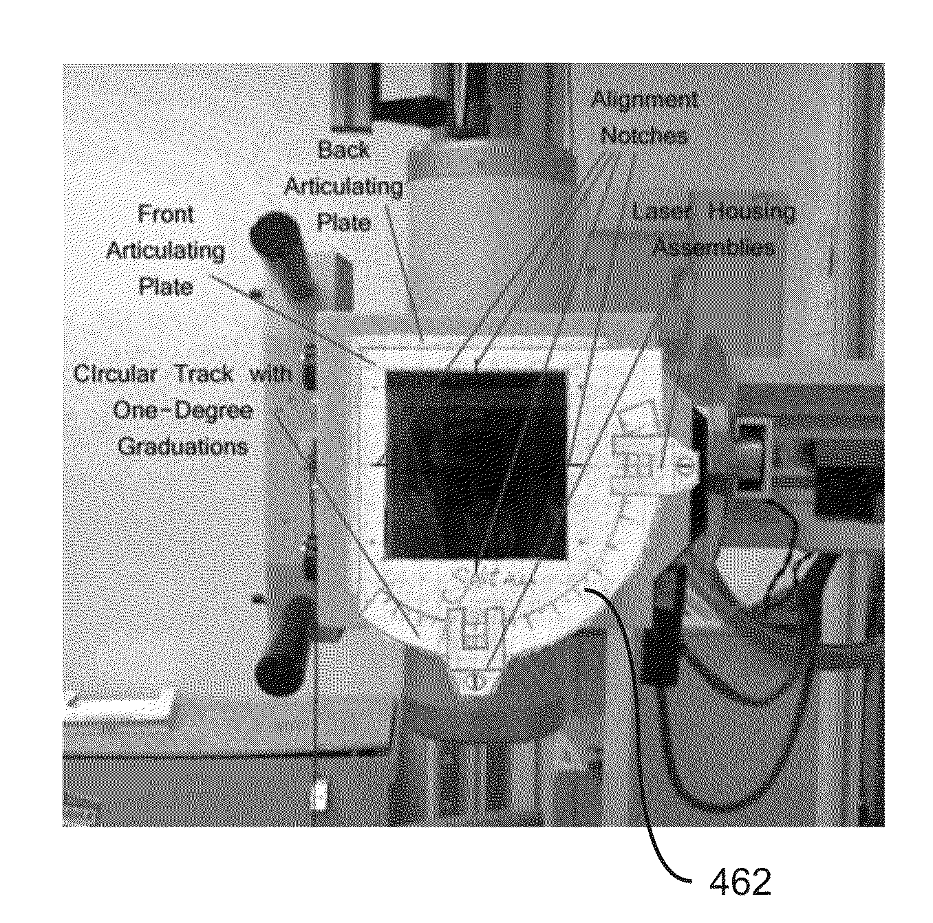 Laser guided patient positioning system for chiropractic x-rays and method of use