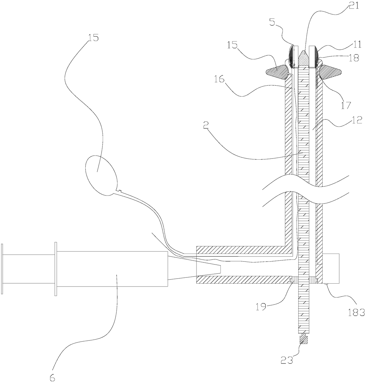 Thread ligating device for anal fistula