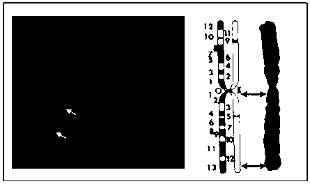 Method for increasing human C5 monoclonal antibody expression yield through targeted screening of foreign gene double-integrated locus