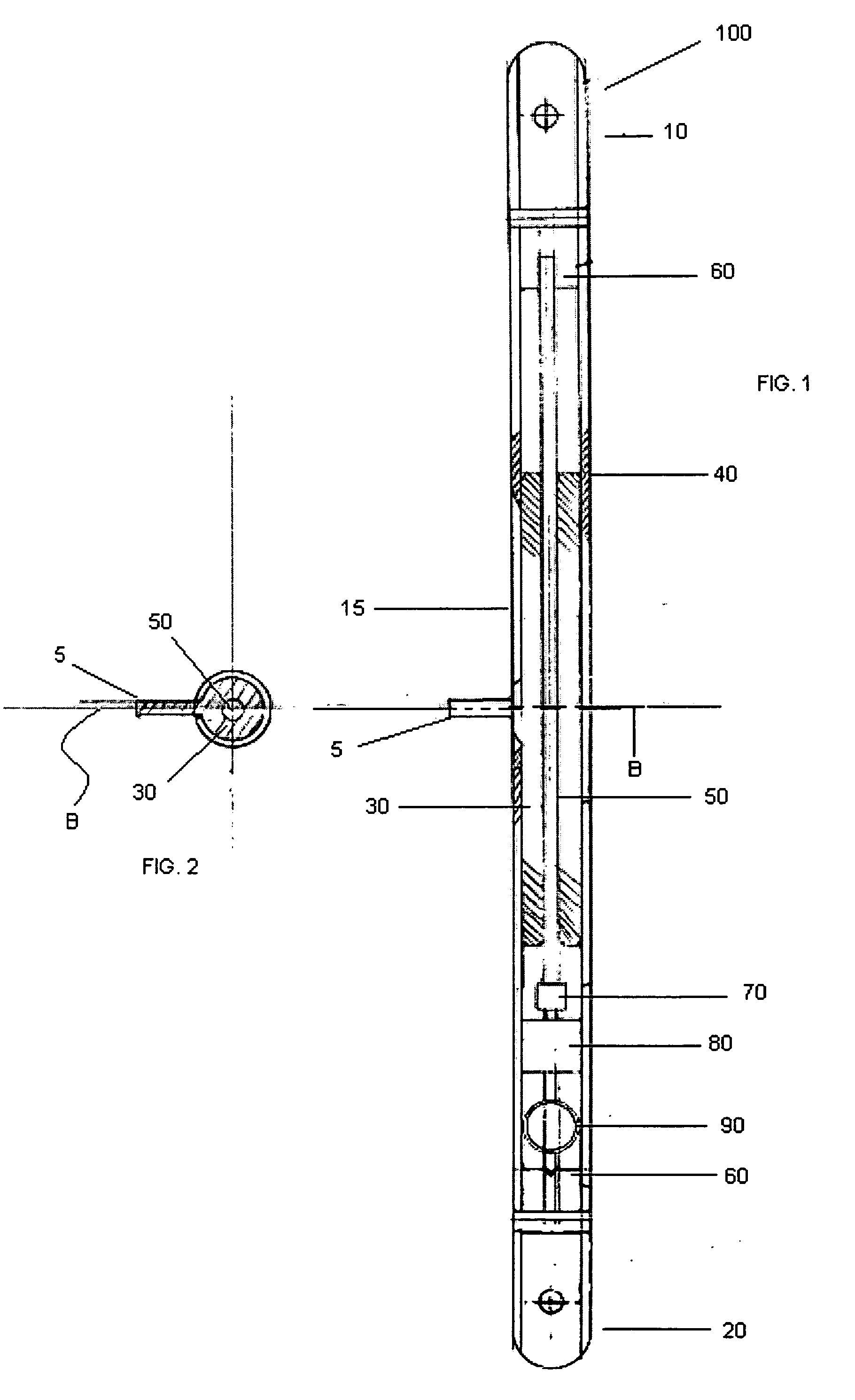 Internal bone transport