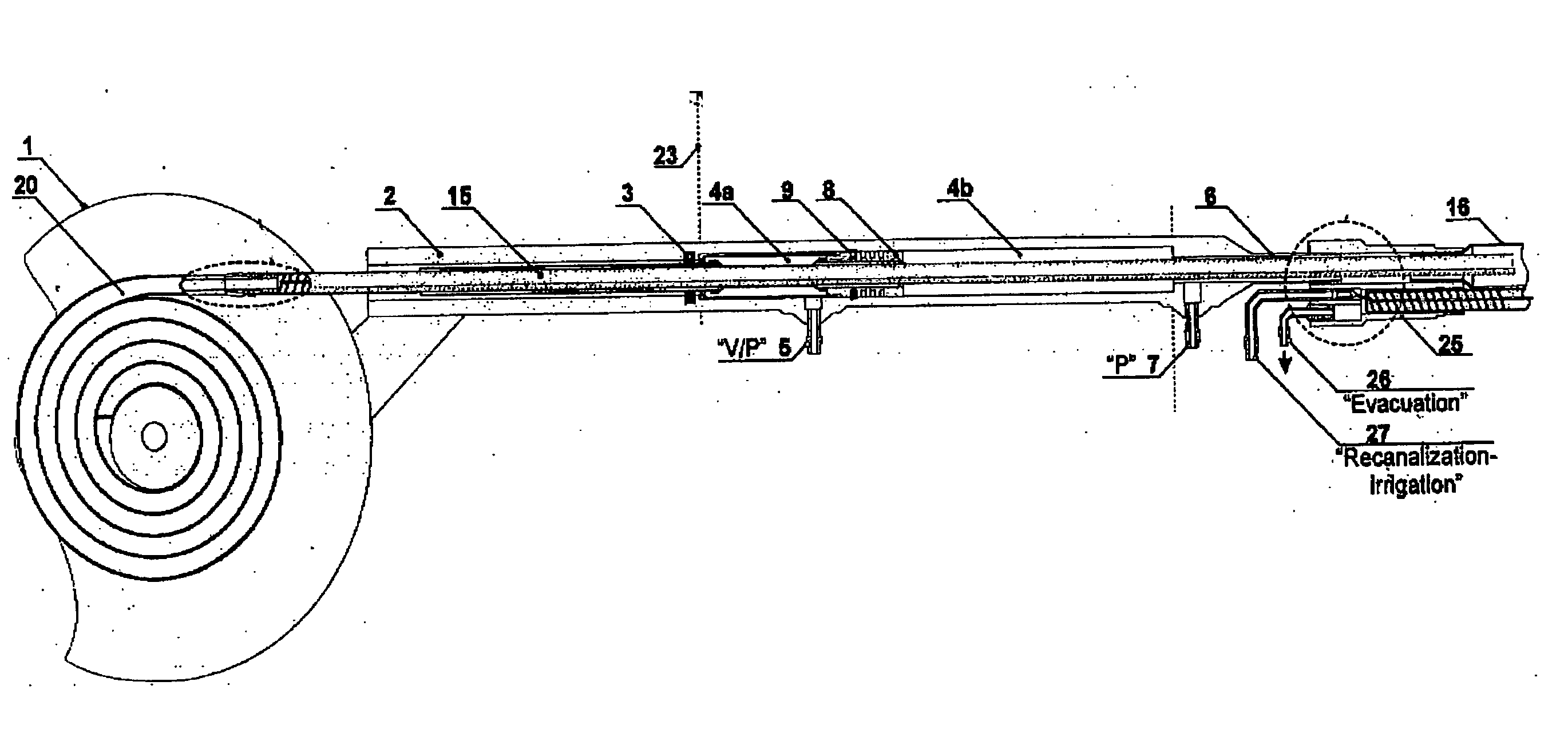 Disposable intestinal intubator with drain and irrigator