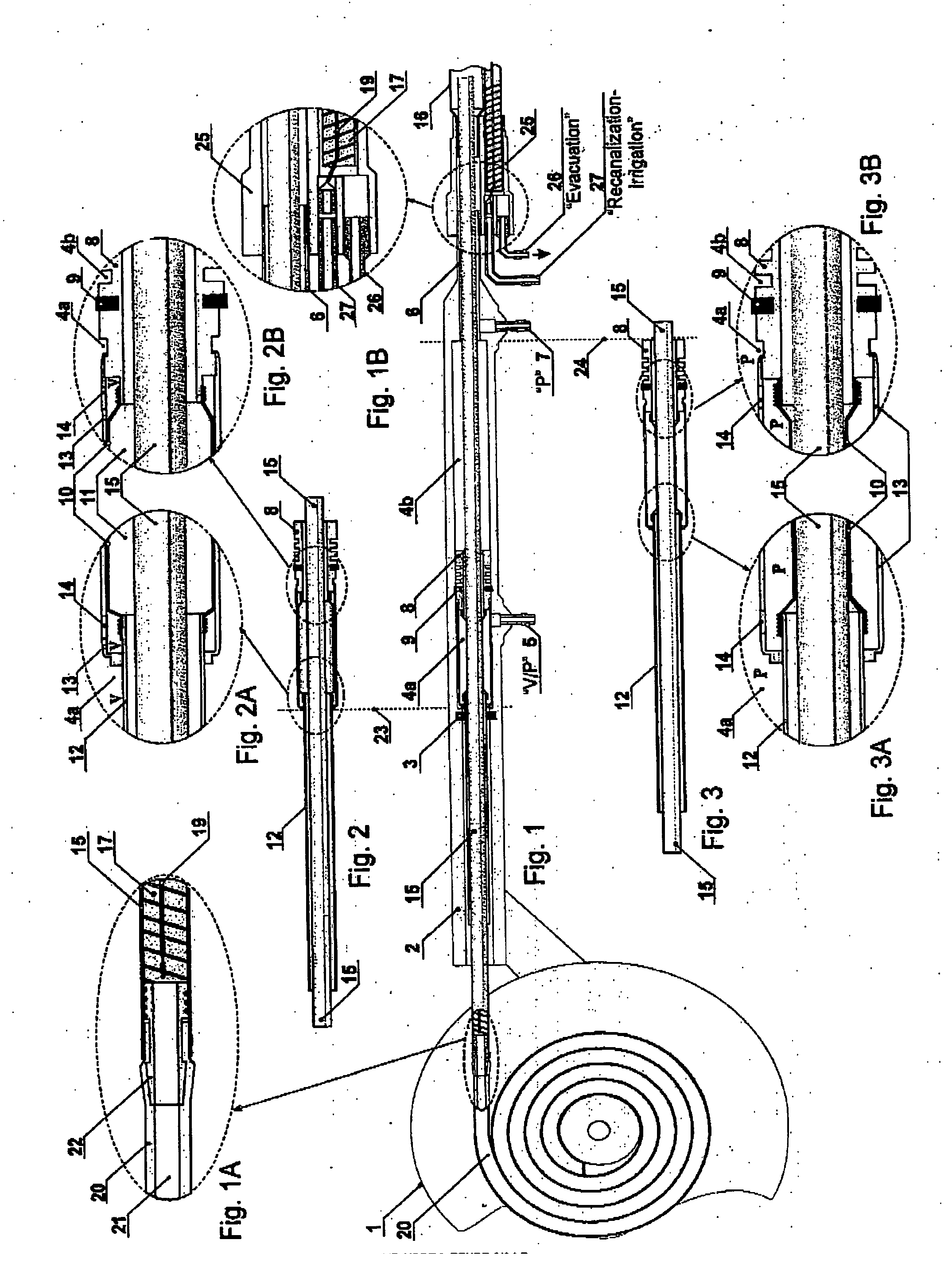 Disposable intestinal intubator with drain and irrigator