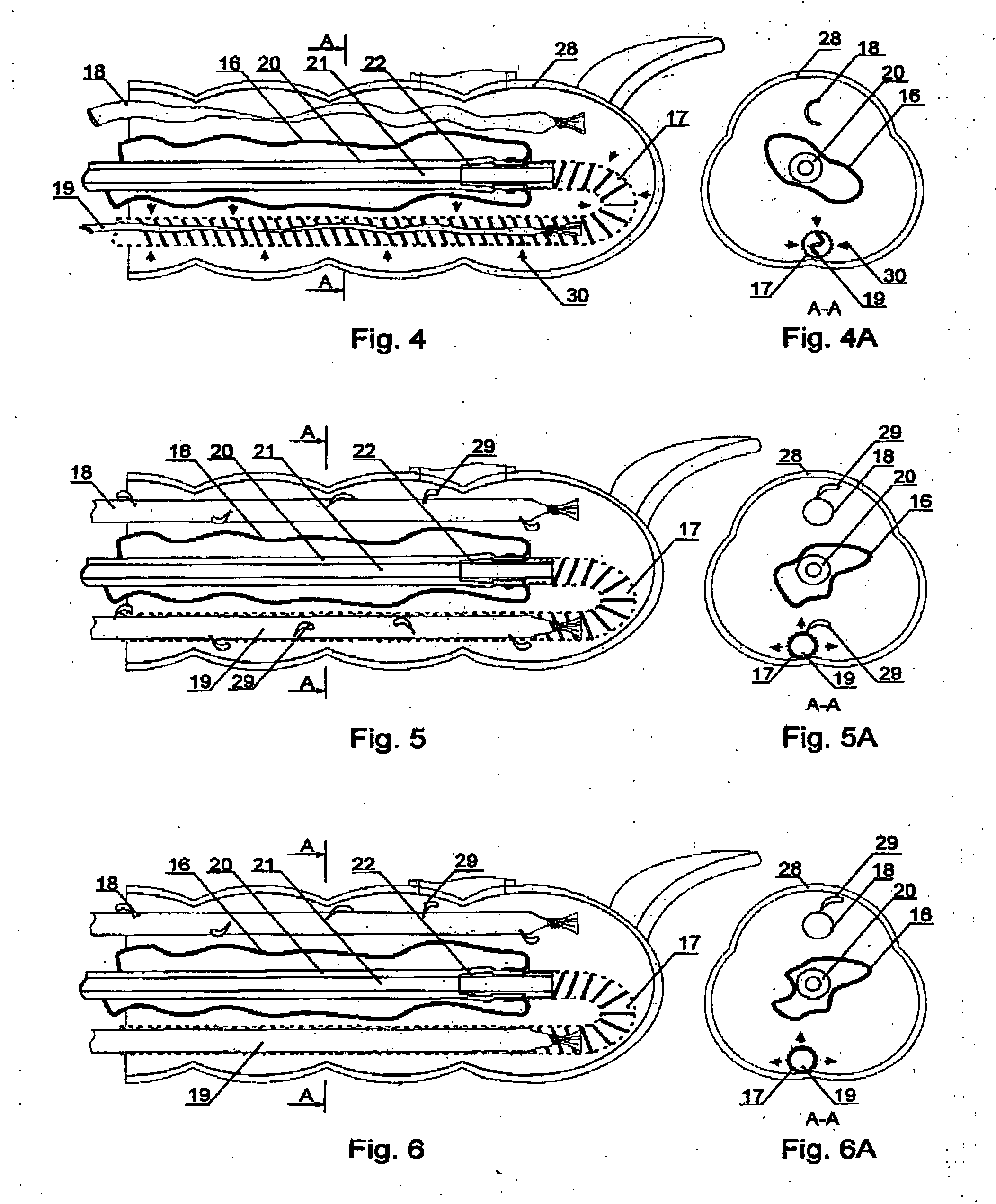 Disposable intestinal intubator with drain and irrigator