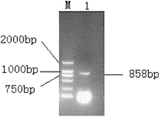 Construction of recombinant bacteria expressing avian encephalomyelitis virus VP1 protein