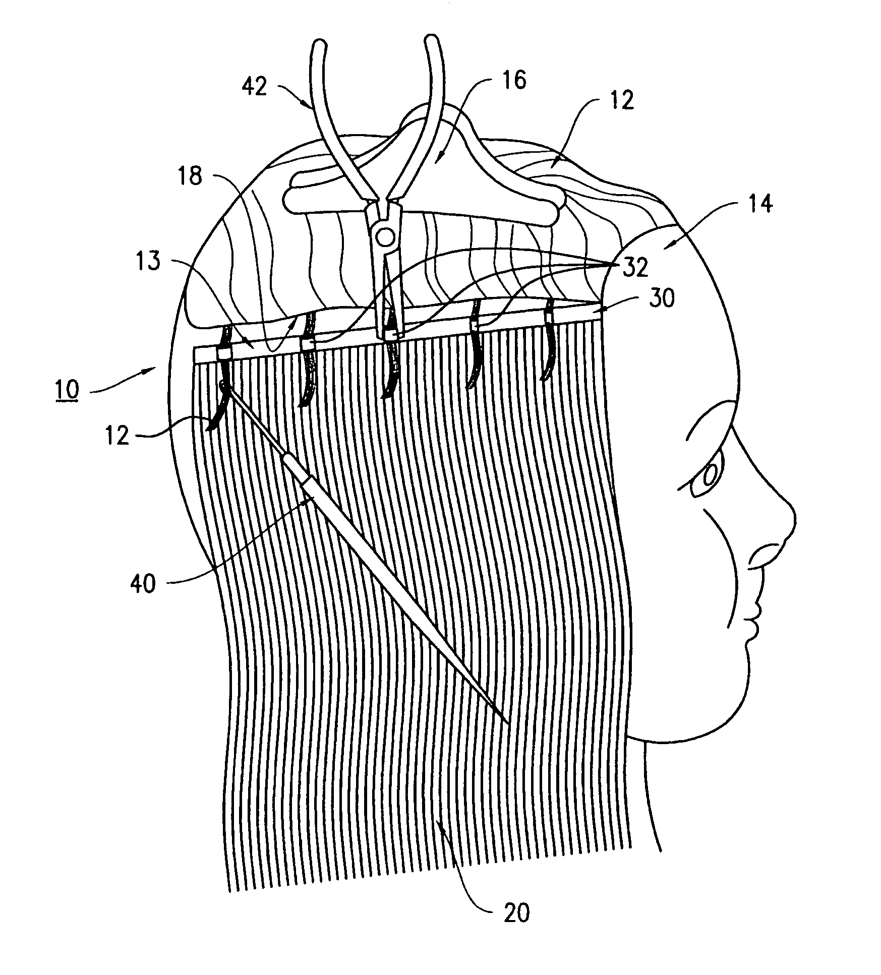 Hairpiece with attachment rings and kit for attaching hairpiece