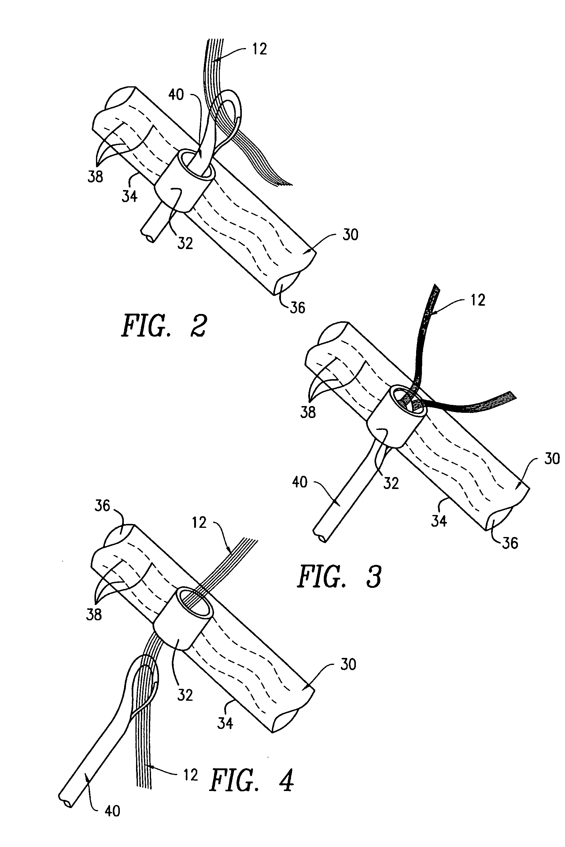 Hairpiece with attachment rings and kit for attaching hairpiece