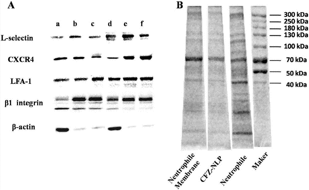 Activated neutrophil membrane coated neutrophil like nanoparticles and preparation method