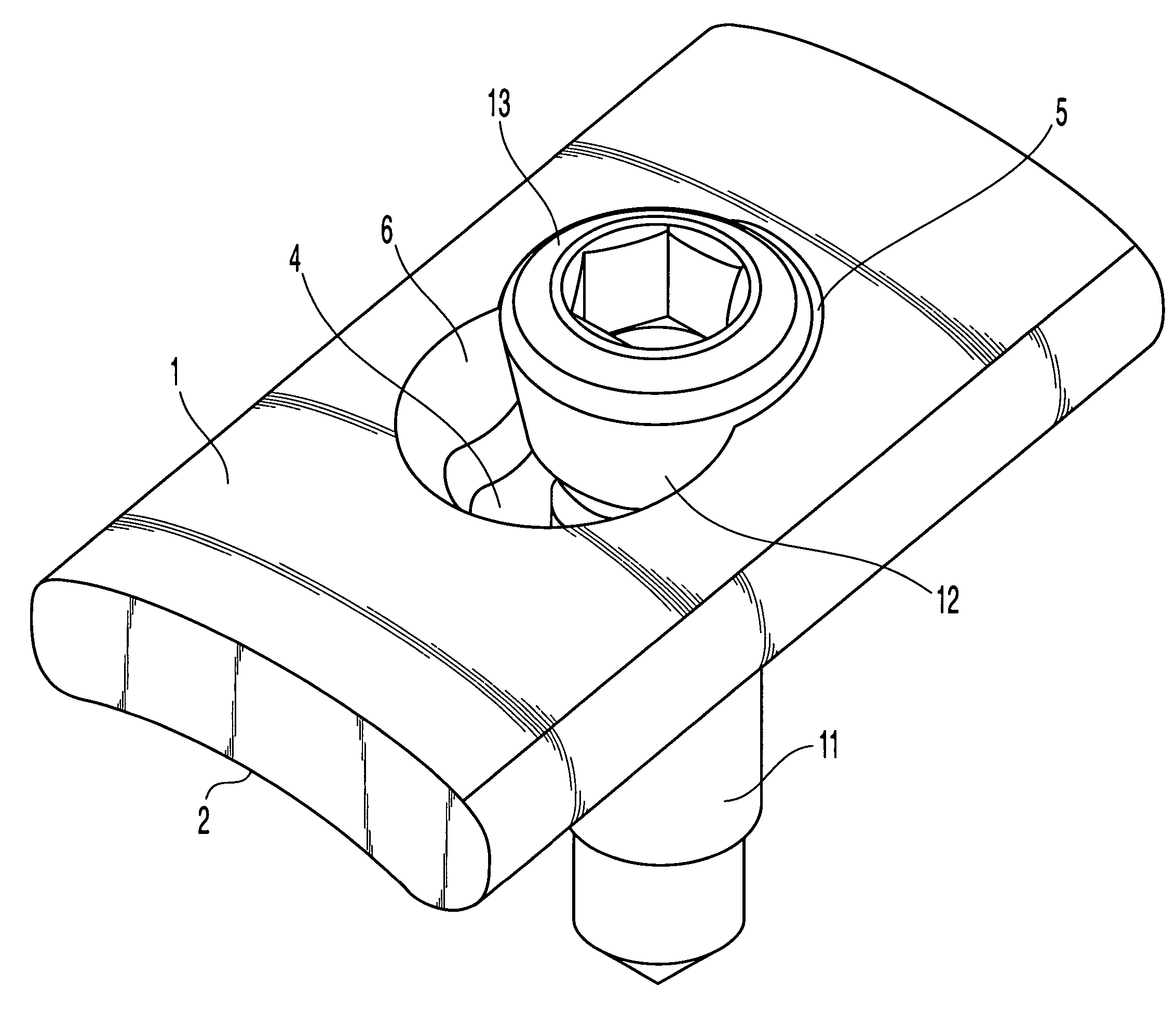 Bone plate