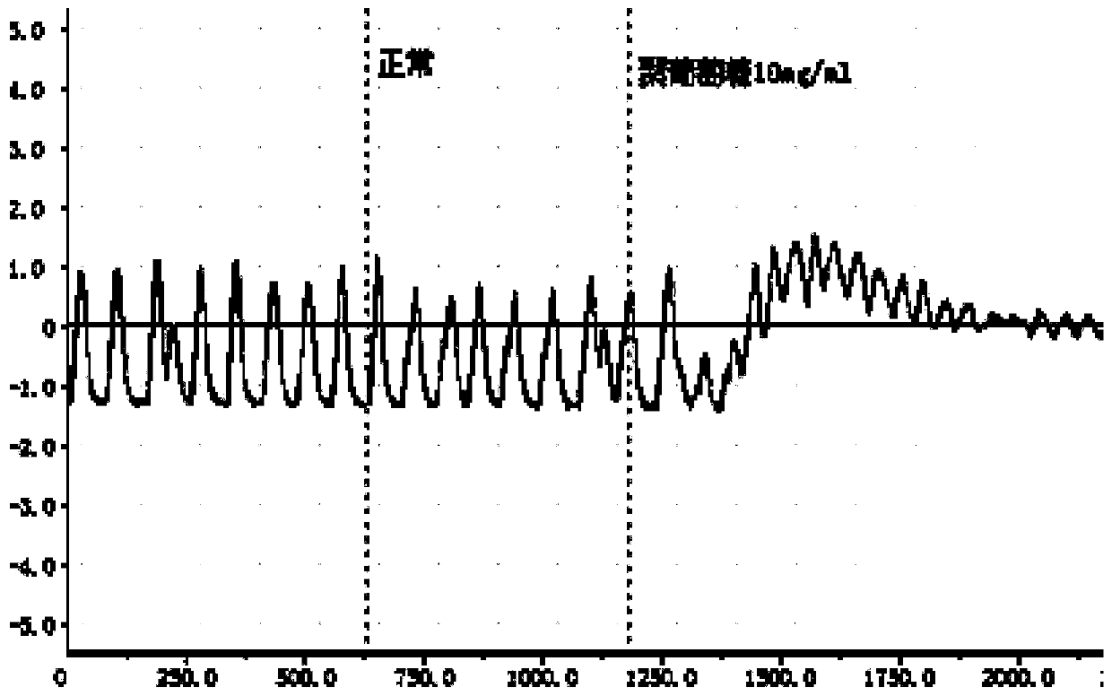 Composition of polydextrose and calcium ion antagonist and application thereof