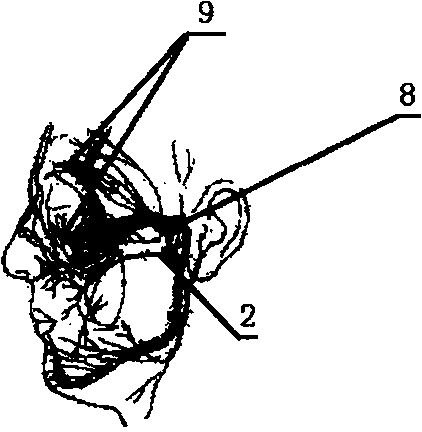 Embedded nerve electrode control system for recovering eyes-closed function