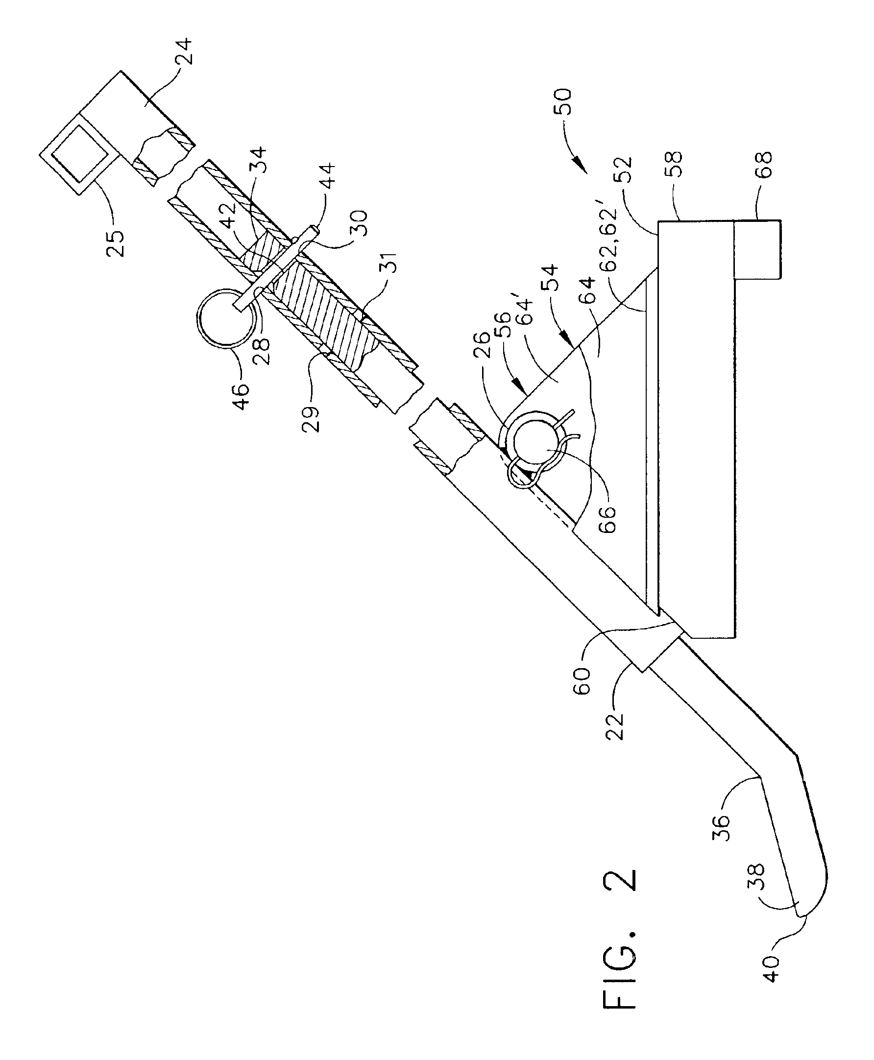 Honeysuckle bush remover