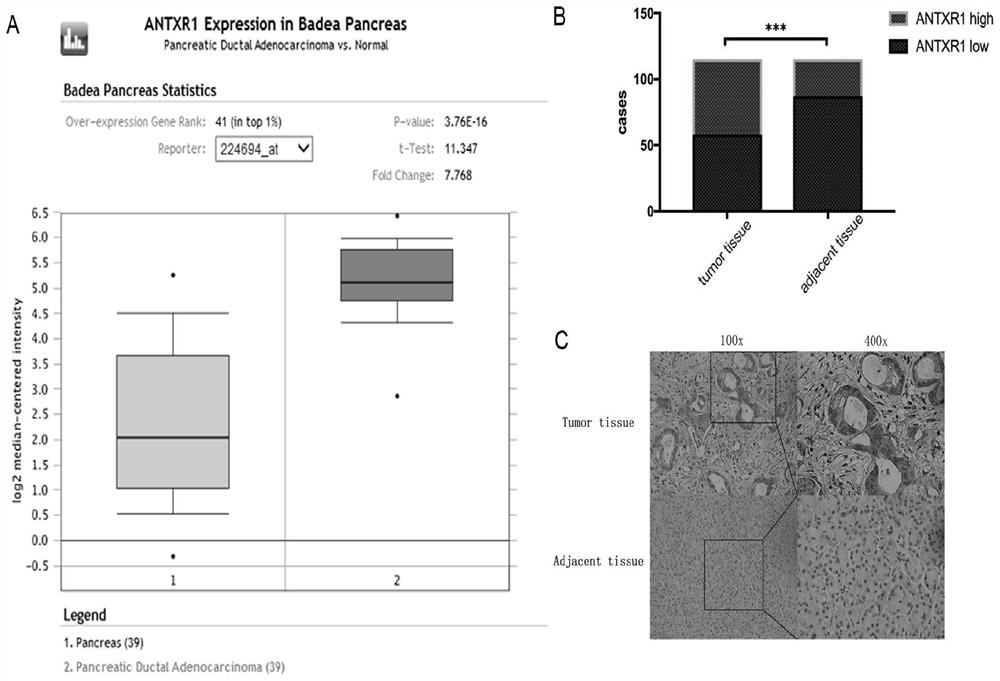 Pancreatic cancer tumor marker and application thereof