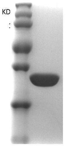 Bovine mycoplasma hypothetical protein MbovP732 and application thereof