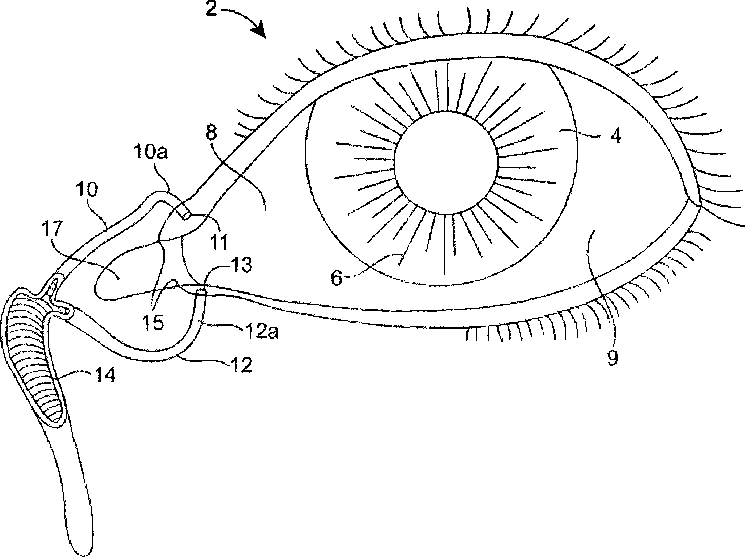 Nasolacrimal drainage system implants for drug therapy