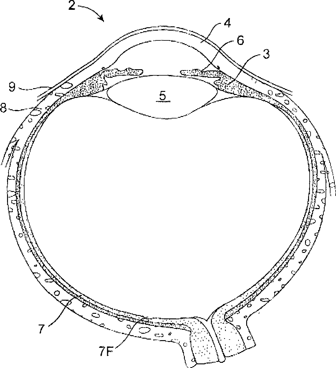 Nasolacrimal drainage system implants for drug therapy