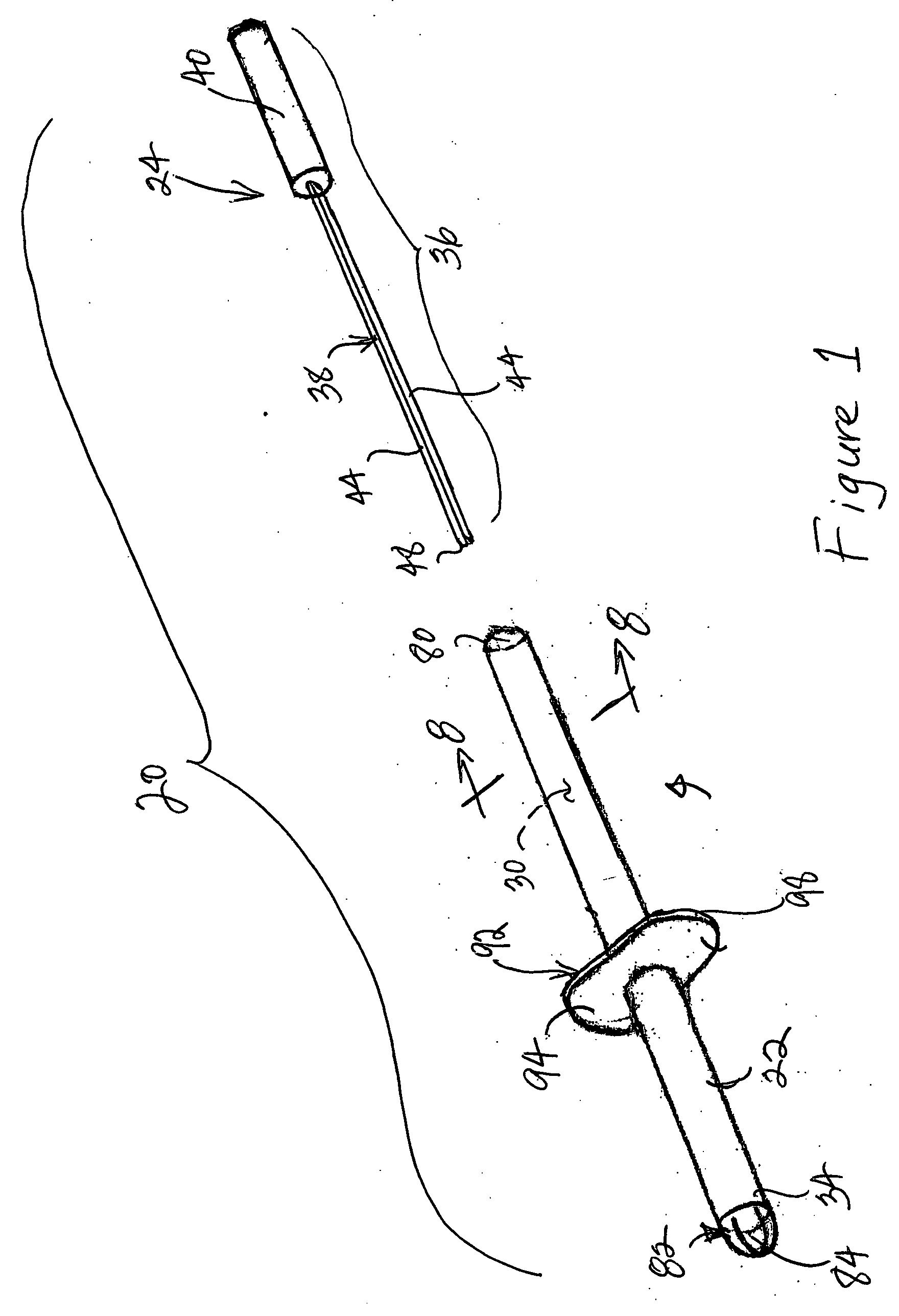 Method and apparatus for delivering a prosthetic fabric into a patient