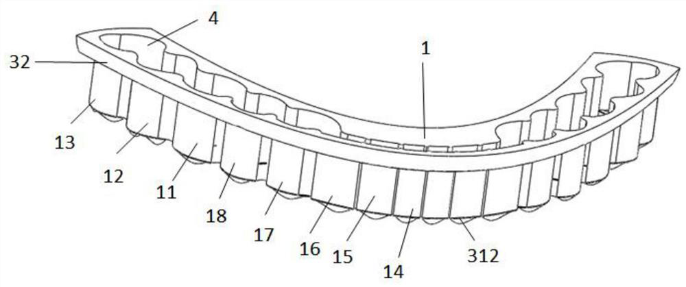 3D printed occlusal splint for the treatment of temporomandibular joint disorders and its preparation method