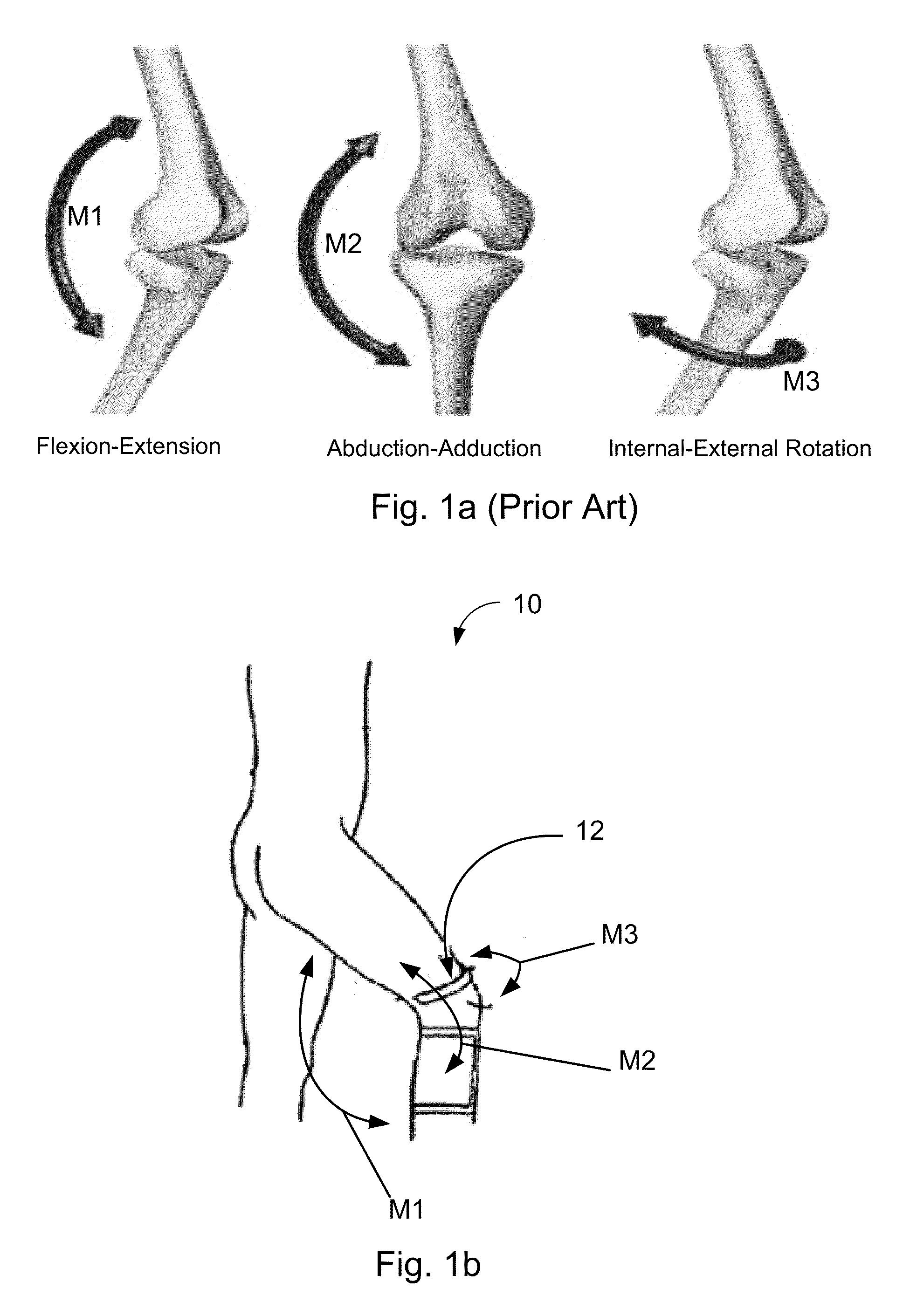 Method and system for human joint treatment plan and personalized surgery planning using 3-D kinematics, fusion imaging and simulation