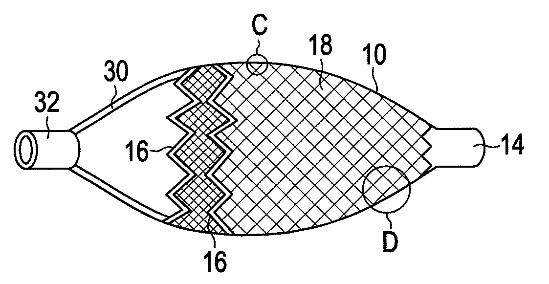 Embolic filter device and method of manufacturing the same