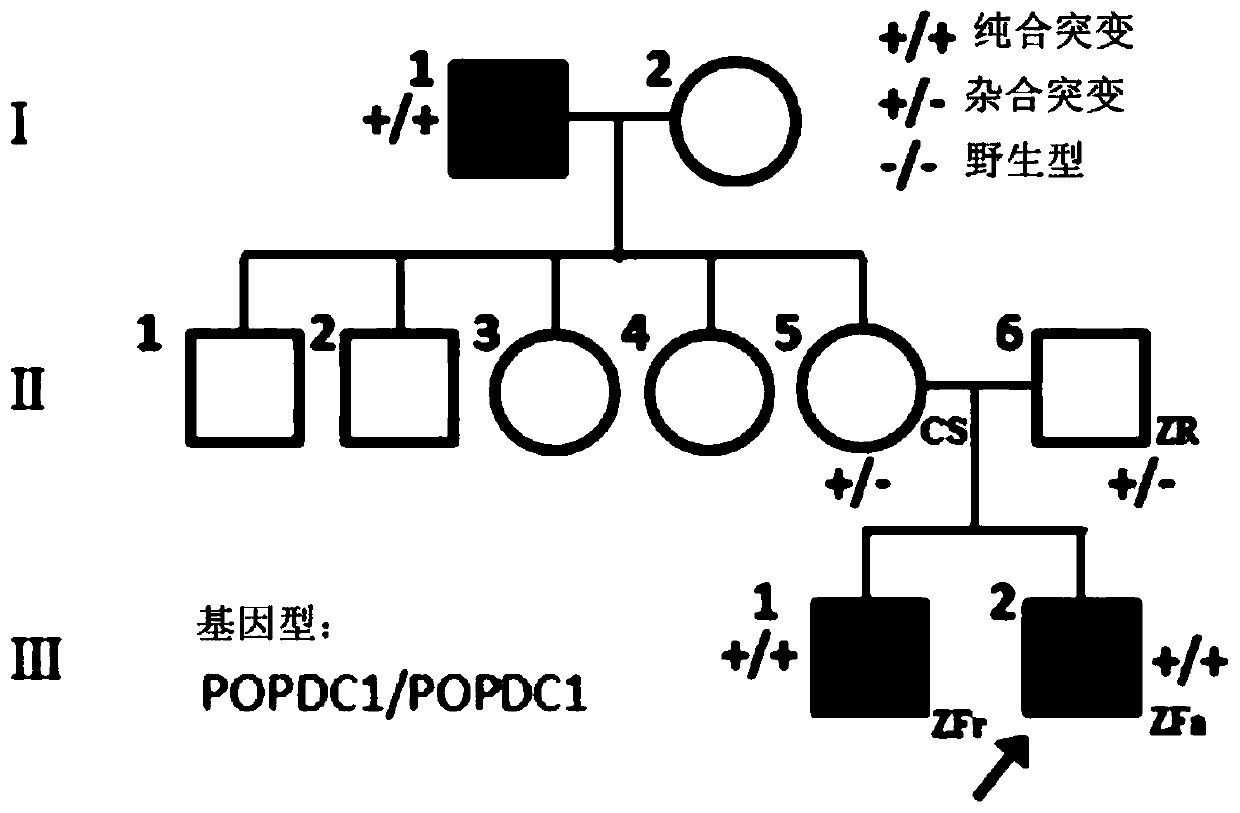 Isolated nucleic acids encoding popdc1 mutants and uses thereof