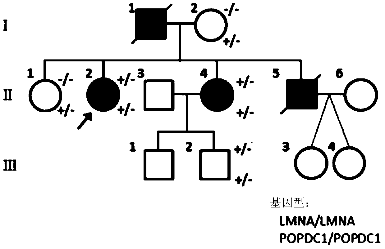 Isolated nucleic acids encoding popdc1 mutants and uses thereof