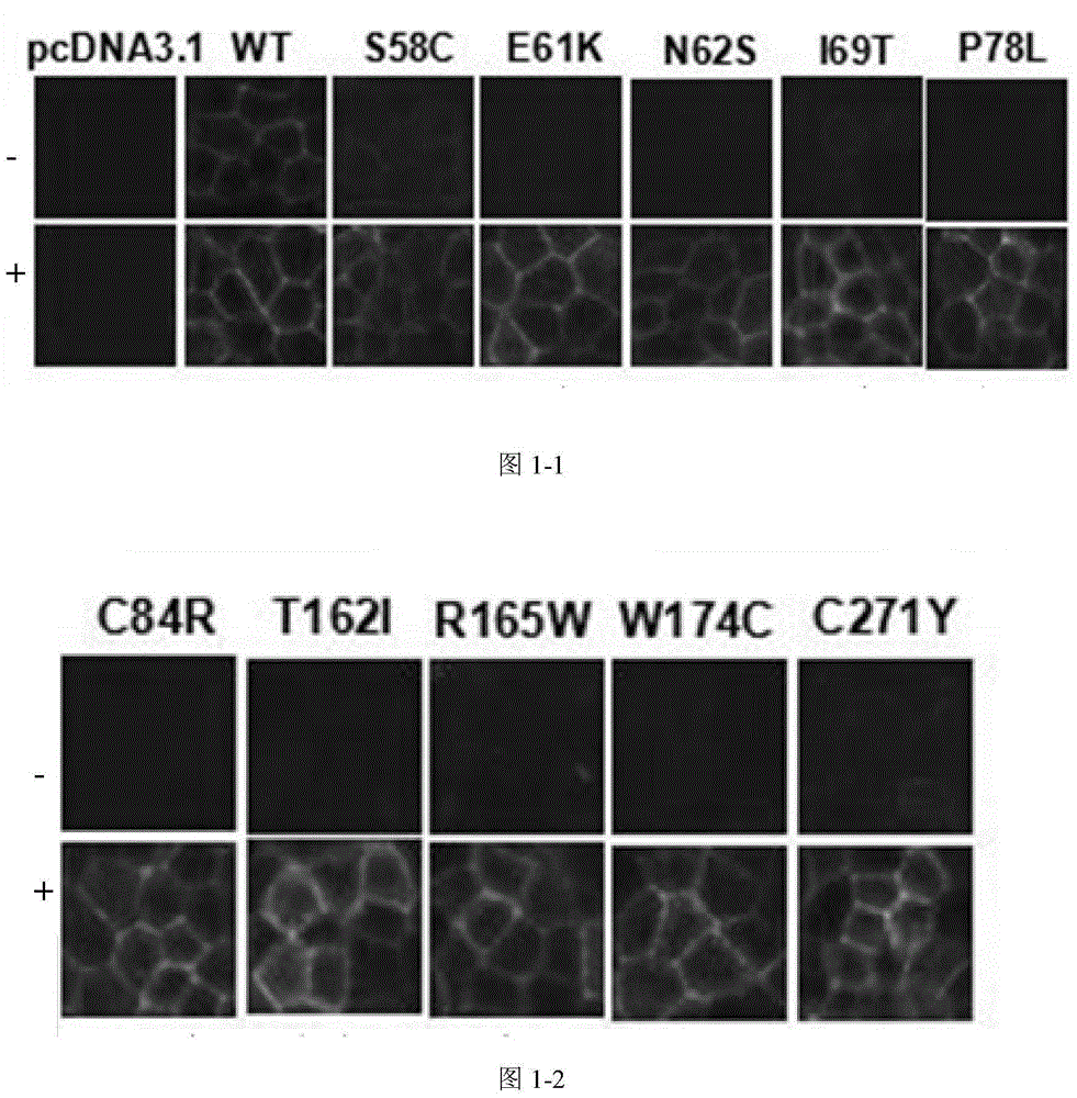 Application of Ipsen17 in preparing medicaments for treating obesity caused by melanocortin-4 receptor