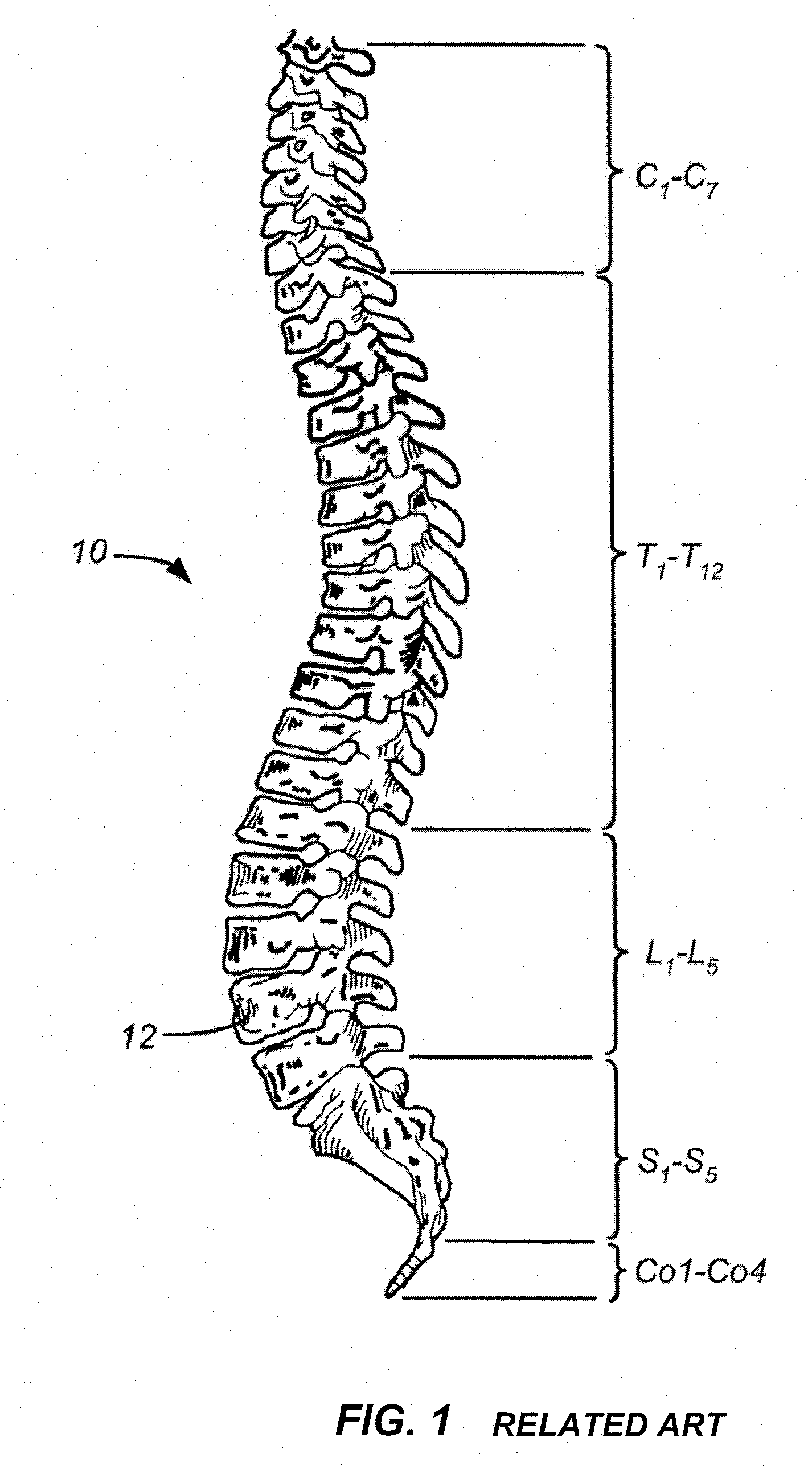 Measurement and trialing system and methods for orthopedic device component selection