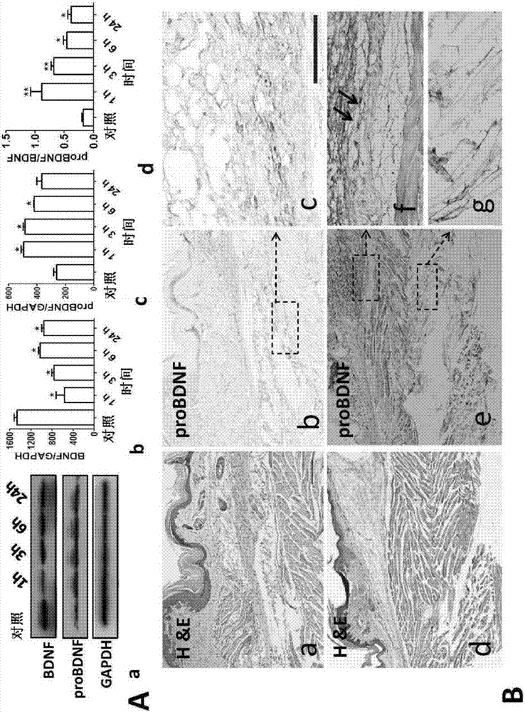 Peripheral brain derived neurotrophic factor (proBDNF) for regulating pain as inflammatory medium