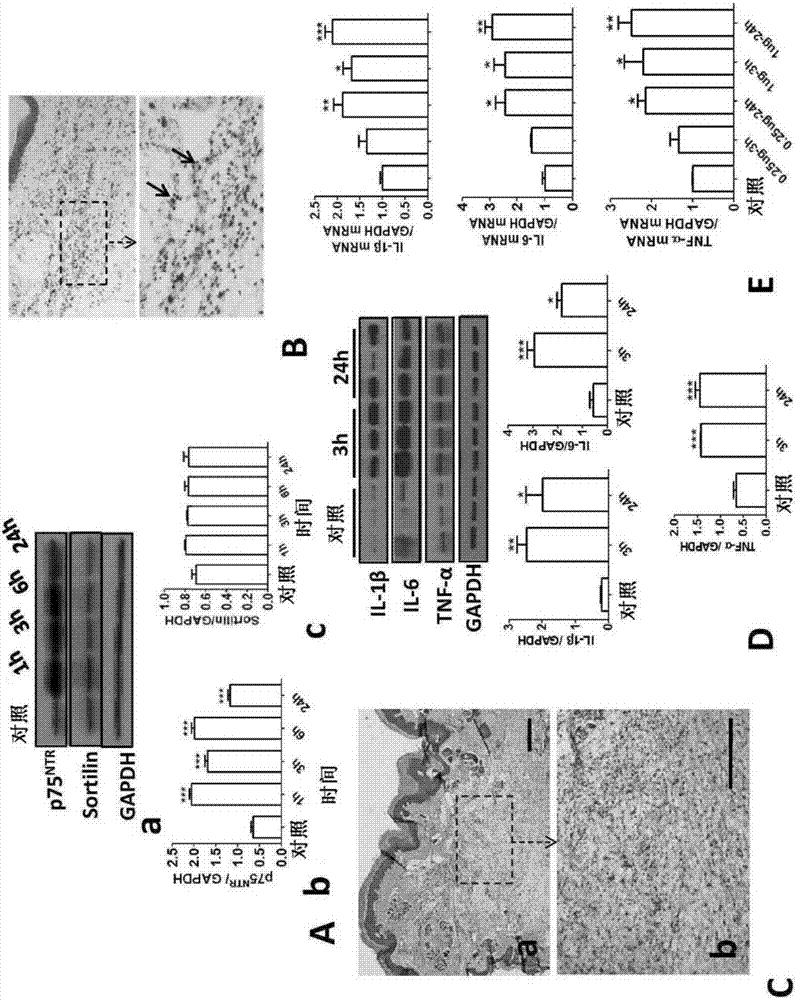 Peripheral brain derived neurotrophic factor (proBDNF) for regulating pain as inflammatory medium