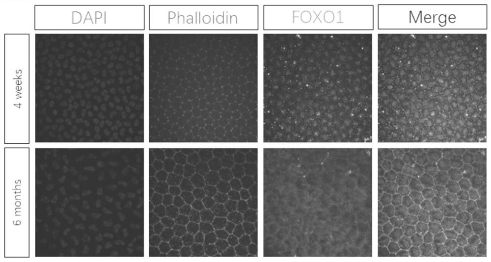 Preparation method and application of cell, tissue or organ cold preservation liquid