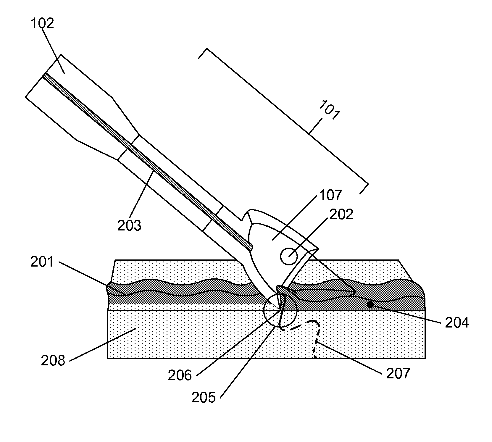 Method for debriding wounds