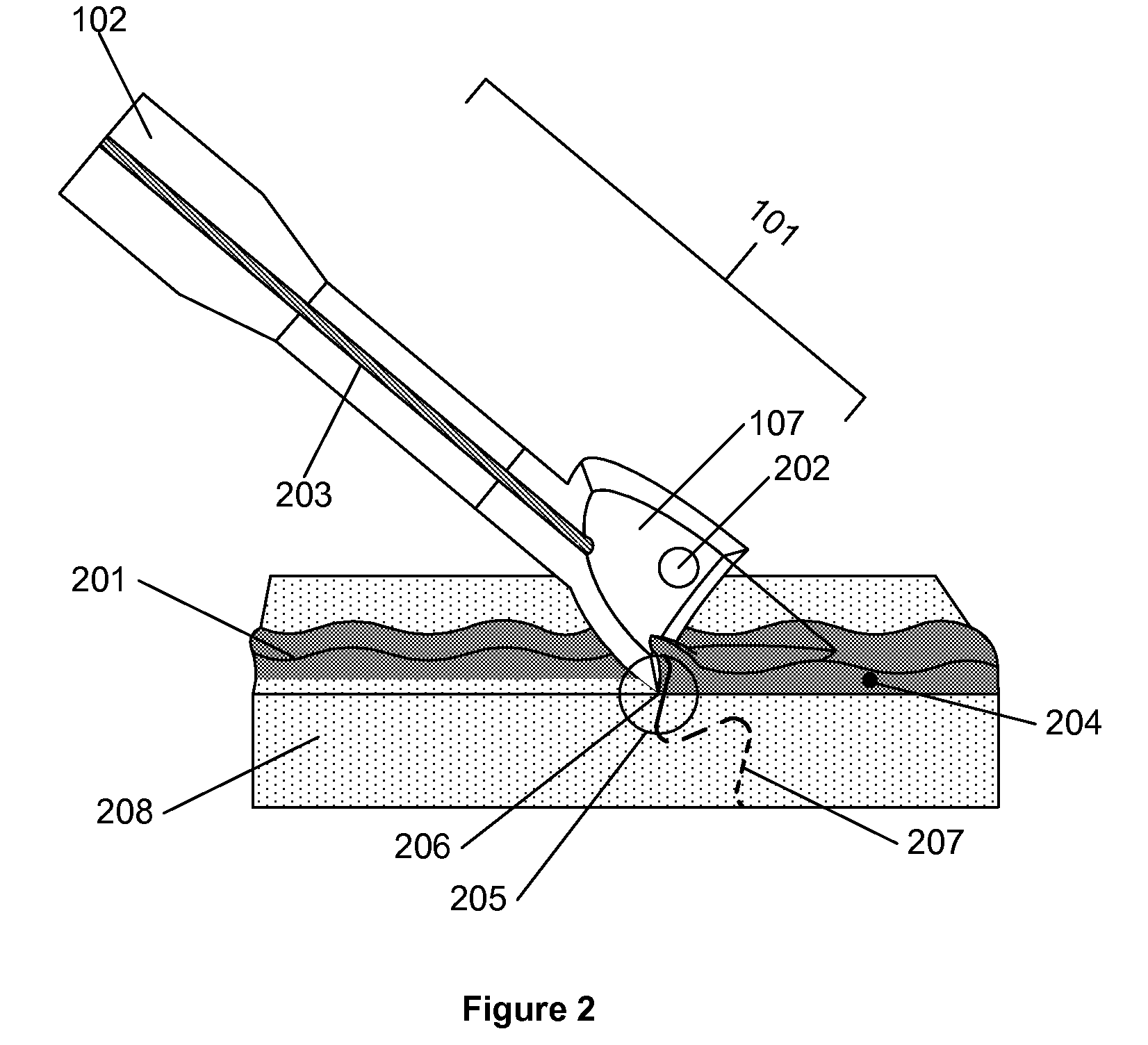 Method for debriding wounds