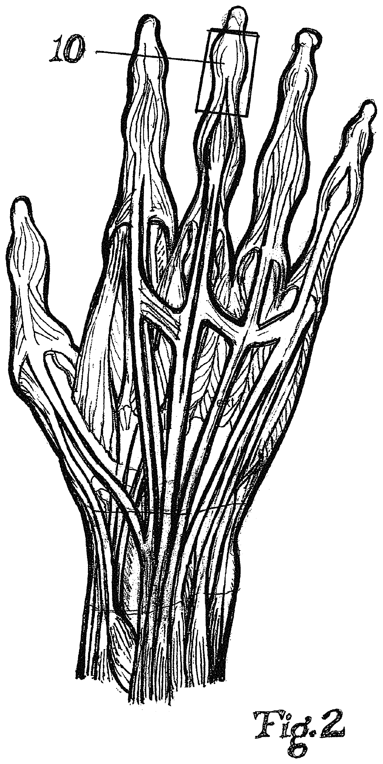 Dynamic taping method for inhibition and elicitation of skeletal muscle tone