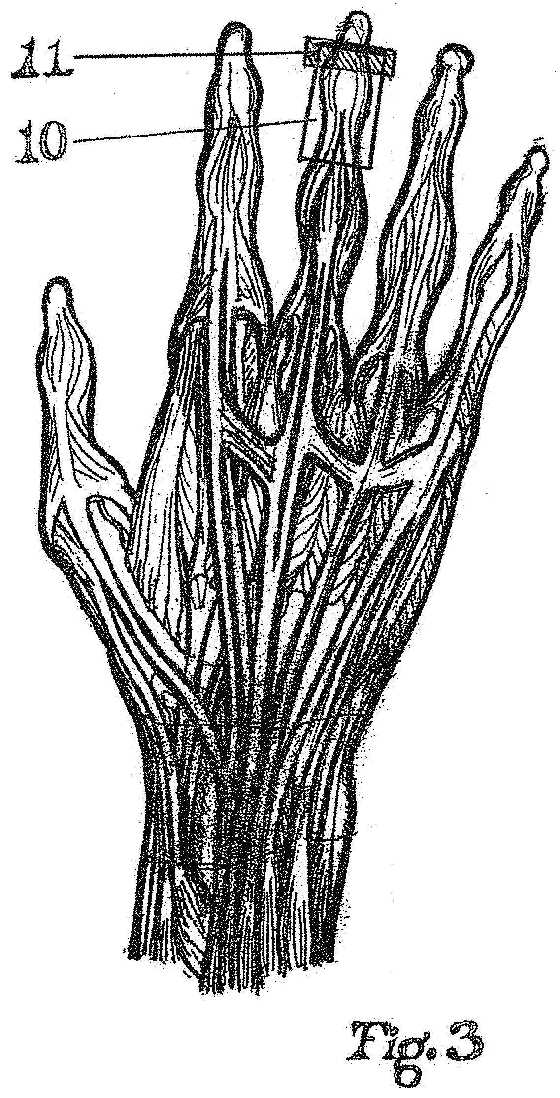 Dynamic taping method for inhibition and elicitation of skeletal muscle tone