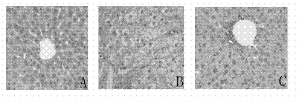 Preparation method of soybean whey polypeptides with liver protection and antioxidation effects