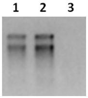 Method for efficiently purifying and identifying cyclic RNA based on second-generation Illumina sequencing platform