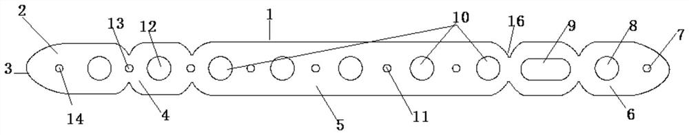 Bone fracture plate for ulna and radius shaft