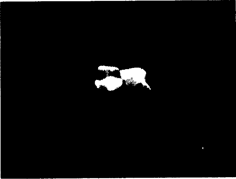 Composite material for repairing deletion of tooth and human hard tissues and its preparation