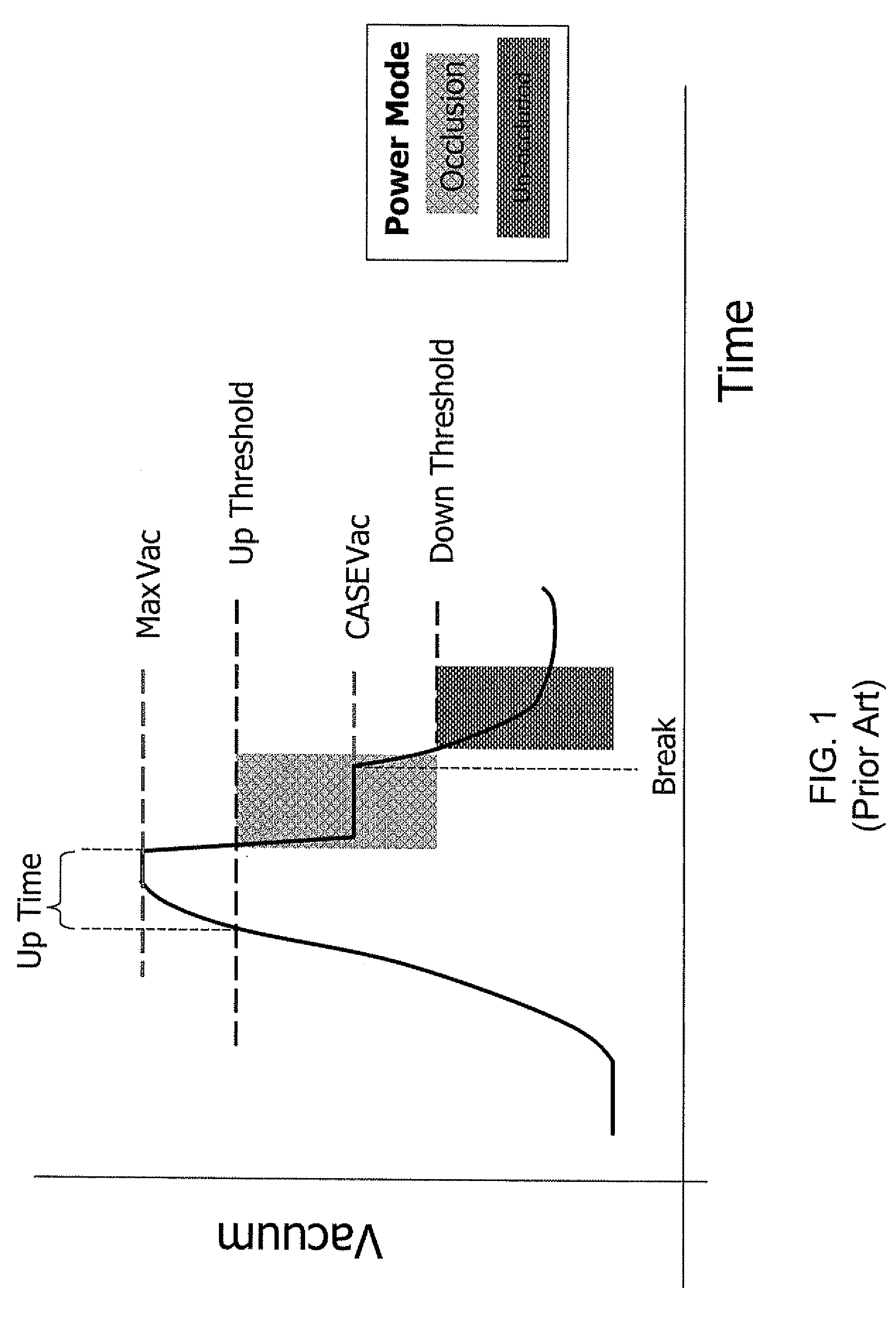 Systems and methods for enhanced occlusion removal during ophthalmic surgery