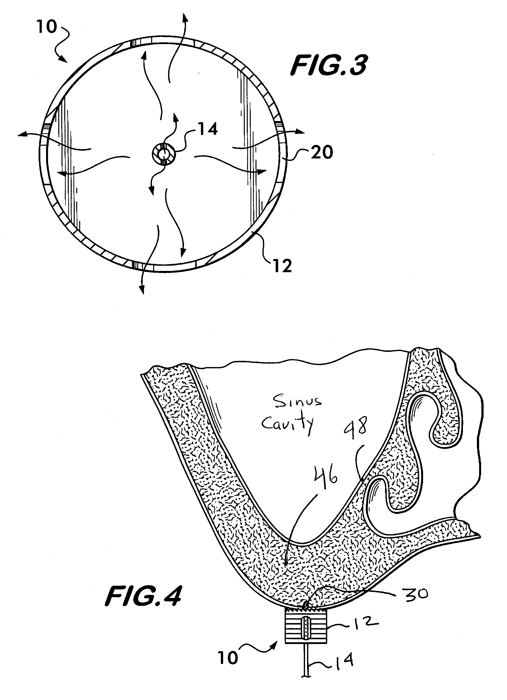 Bone cutting device and method of using same